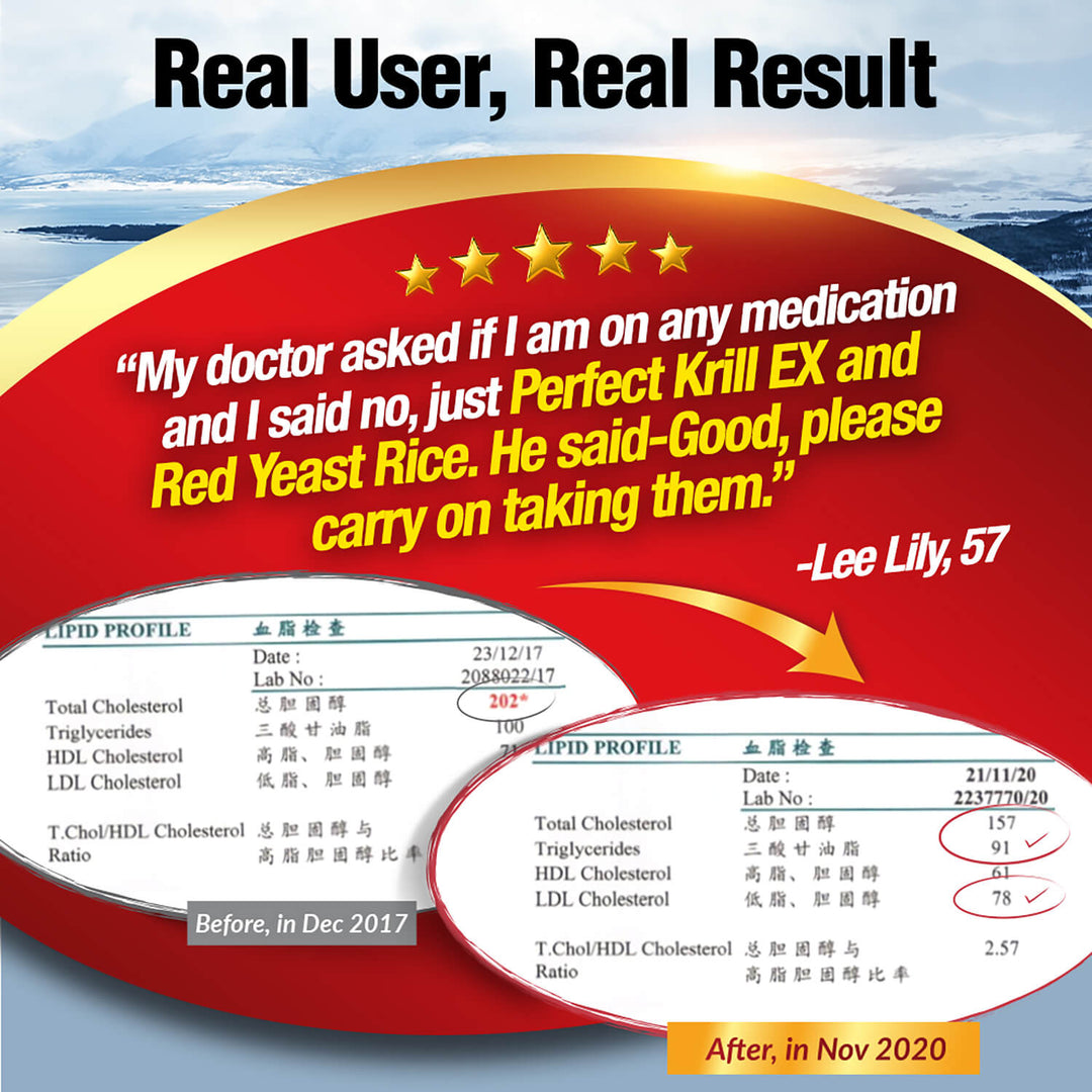 LABO Nutrition Perfect Krill EX Antarctic Krill Oil Omega 3 Phospholipid Intensive for Cholesterol - Lifestream Group US