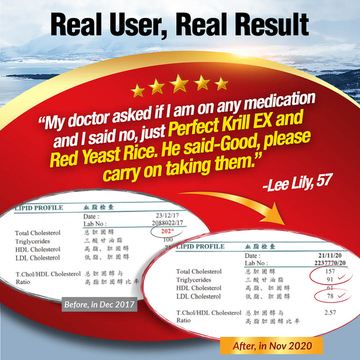 LABO Nutrition Perfect Krill EX Antarctic Krill Oil Omega 3 Phospholipid Intensive for Cholesterol - Lifestream Group US