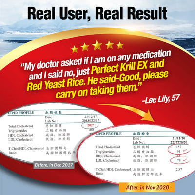 LABO Nutrition Perfect Krill EX Antarctic Krill Oil Omega 3 Phospholipid Intensive for Cholesterol