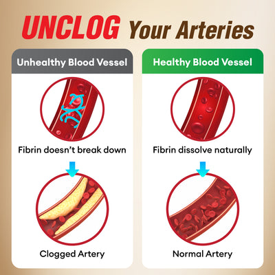 LABO Nutrition VesseCLEAR 确保通EX Nattokinase - Clean Flexible Blood Vessels Dissolve Clot - Lifestream Group US