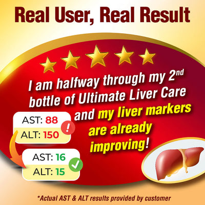AFC Ultimate Liver Care  究极护肝素 养肝 排毒 护肝 补肝 解酒 姜黄素 Natural Liver Detox for Fatty Liver & Hangover - Turmeric Curcuminoid